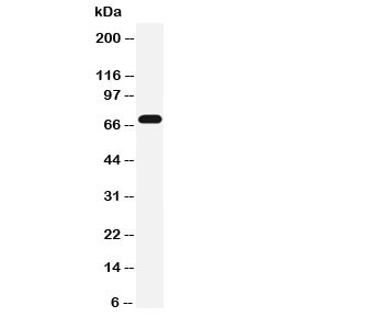 Serotonin Transporter Antibody WB. Western blot testing of Serotonin transporter antibody and rat brain tissue lysate. Expected molecular weight: ~70/85-95kDa (unmodified/glycosylated).