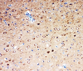 Serotonin Transporter Antibody Rat Brain IHC. Immunohistochemistry testing of Serotonin transporter antibody and rat brain tissue.