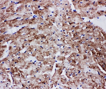 IHC-P: GLUT4 antibody testing of rat heart tissue