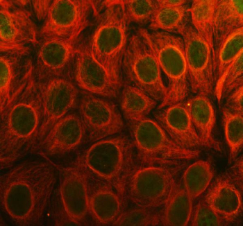 Immunofluorescent staining of FFPE human Caco-2 cells with PAK6 antibody (green) and Alpha Tubulin mAb (red). HIER: steam section in pH6 citrate buffer for 20 min.