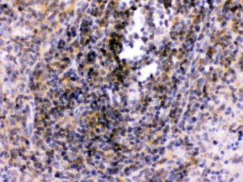 IHC staining of FFPE rat spleen tissue with TLR7 antibody. HIER: boil tissue sections in pH6 citrate buffer for 20 min and allow to cool before testing.