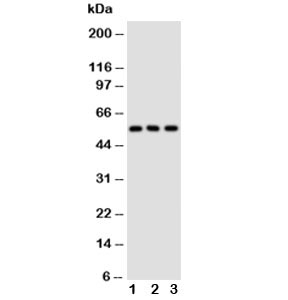 GLUT5 Antibody Rodent Tissues WB. Western blot analysis of GLUT5 expression using a GLUT5 antibody. Lane 1: rat kidney tissue lysate. Lane 2: rat liver tissue lysate. Lane 3: mouse kidney tissue lysate. GLUT5, also known as Fructose Transporter Protein, is a facilitative glucose transporter family member responsible for fructose uptake and metabolism. A prominent band is detected at approximately 55 kDa in all samples, consistent with the expected molecular weight of GLUT5. These results demonstrate endogenous expression of GLUT5 in rodent tissues and support the utility of this antibody for studies of fructose transport, carbohydrate metabolism, and nutrient homeostasis.