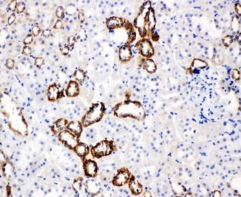 GLUT5 Antibody Rat Kidney IHC. Immunohistochemical staining of rat kidney demonstrates GLUT5 expression using a GLUT5 antibody. GLUT5, also known as Fructose Transporter Protein, is a facilitative transporter responsible for fructose uptake and plays an important role in carbohydrate metabolism and nutrient homeostasis. Strong membranous staining is observed in renal tubular epithelial cells, consistent with the known localization of GLUT5 in kidney tissues involved in fructose reabsorption and transport. Heat induced epitope retrieval and immunoperoxidase staining reveal robust expression of this fructose transporter in rat kidney. These results support the utility of GLUT5 Antibody for studies of fructose metabolism, renal physiology, and metabolic regulation.