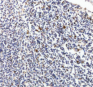 Granzyme B Antibody Human Appendix Immune Cell IHC. Immunohistochemical staining of FFPE human appendix tissue using GZMB Antibody at 2 ug/ml. HIER was performed in pH 8.0 EDTA buffer. An HRP-conjugated goat anti-rabbit IgG secondary antibody with DAB substrate was used for detection. Granzyme B Antibody, a Cytotoxic Lymphocyte Marker Antibody, demonstrates strong granular cytoplasmic staining in scattered immune cells within the appendiceal lymphoid tissue, consistent with granzyme B expression in activated cytotoxic T lymphocytes and natural killer cells.