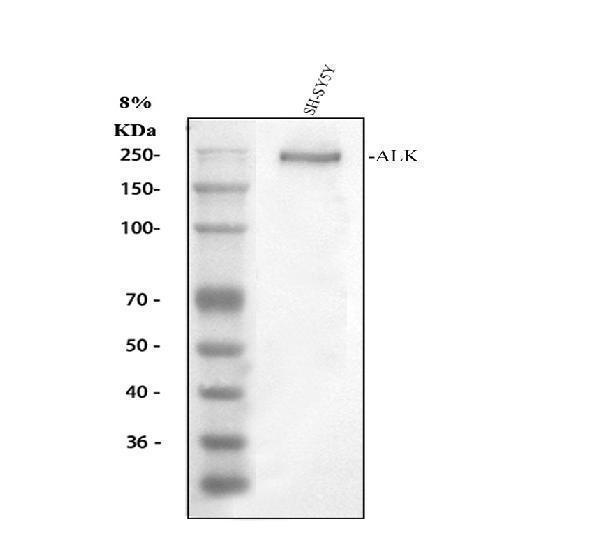 ALK Antibody SH-SY5Y Cell WB. Western blot testing of human SH-SY5Y cell lysate with ALK antibody at 0.5 ug/ml. A distinct immunoreactive band is detected at approximately 250 kDa, consistent with the mature glycosylated form of Anaplastic Lymphoma Kinase (ALK). Although the predicted core molecular weight is approximately 176 kDa, ALK commonly migrates at a higher apparent molecular weight due to extensive post-translational glycosylation. This receptor tyrosine kinase regulates neuronal development, cell differentiation, and intracellular signaling pathways.