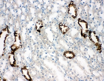 IHC-F testing of AQP2 antibody and rat kidney tissue