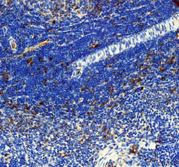Immunohistochemical staining of FFPE rat spleen tissue with IL-3 antibody, HRP-secondary and DAB substrate. HIER: boil tissue sections in pH8 EDTA for 20 min and allow to cool before testing.