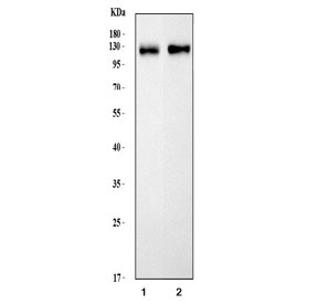 MAG Antibody Rat and Mouse Brain WB. Western blot analysis was performed using MAG Antibody. Lane 1: rat brain tissue lysate; lane 2: mouse brain tissue lysate. A strong immunoreactive band is detected in both samples at approximately 98 kDa, within the commonly observed migration range of 68-98 kDa for Myelin Associated Glycoprotein, reflecting variable levels of glycosylation. The robust signal in both brain lysates is consistent with the abundant expression of MAG in oligodendrocyte myelin membranes. These results demonstrate that this Axon-Glia Interaction Protein Antibody is suitable for Western blot detection of endogenous MAG in rat and mouse brain tissue lysates.