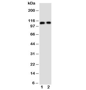 Western blot testing of TRPC6 antibody and Lane 1:  rat lung;  2: human 293T cell lysate. Predicted molecular weight: ~106 kDa.