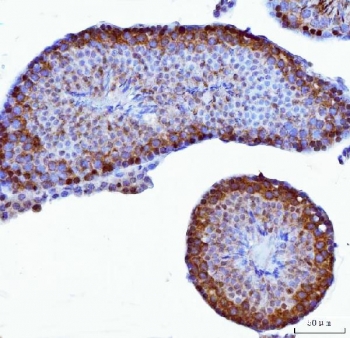 IHC staining of FFPE mouse testis tissue with YB1 antibody. HIER: boil tissue sections in pH8 EDTA for 20 min and allow to cool before testing.