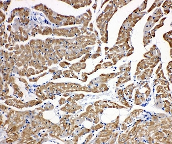 IHC-P: Troponin C antibody testing of rat heart tissue
