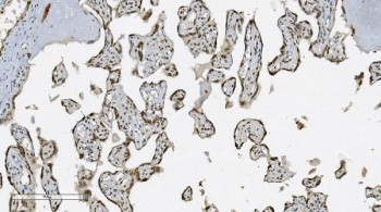 Aryl Hydrocarbon Receptor Antibody Placenta IHC. Immunohistochemical staining of FFPE human placental tissue demonstrates AHR expression using an Aryl Hydrocarbon Receptor antibody. AHR, also known as an Environmental Sensor Protein, is a ligand activated transcription factor that regulates xenobiotic metabolism, immune tolerance, and developmental signaling pathways. Prominent nuclear and cytoplasmic staining is observed in trophoblastic cells lining the chorionic villi, consistent with the established role of AHR in placental development and maintenance of the maternal fetal interface. Heat induced epitope retrieval was performed by boiling tissue sections in pH 8 EDTA buffer for 20 minutes followed by cooling prior to staining. These results support the utility of AHR Antibody for studies of reproductive biology, developmental signaling, and environmental response mechanisms.