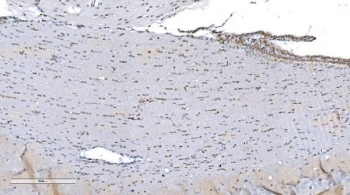 Aryl Hydrocarbon Receptor Antibody Mouse Brain IHC. Immunohistochemical staining of FFPE mouse brain tissue demonstrates AHR expression using an Aryl Hydrocarbon Receptor antibody. AHR, also known as an Environmental Sensor Protein, is a ligand activated transcription factor that integrates signals from dietary metabolites, microbiota derived compounds, and environmental ligands to regulate neurodevelopment and immune homeostasis. Scattered nuclear and cytoplasmic staining is observed in neuronal and glial populations, with increased reactivity in cells adjacent to the ventricular surface, consistent with the emerging role of AHR in central nervous system function and neuroinflammatory signaling. Heat induced epitope retrieval was performed by boiling tissue sections in pH 8 EDTA buffer for 20 minutes followed by cooling prior to staining. These results support the utility of AHR Antibody for studies of neurobiology, environmental sensing, and transcriptional regulation.