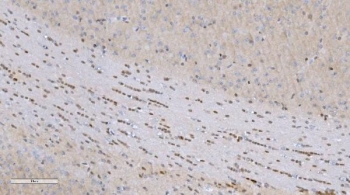 Aryl Hydrocarbon Receptor Antibody Cerebellum IHC. Immunohistochemical staining of FFPE mouse brain tissue demonstrates AHR expression using an Aryl Hydrocarbon Receptor antibody. AHR, also known as an Environmental Sensor Protein, is a ligand activated transcription factor that regulates responses to endogenous metabolites and environmental stimuli. Distinct nuclear staining is observed in linear arrays of cells within the cerebellar white matter and adjacent neuronal layers, consistent with the expression of AHR in specialized neural and glial populations involved in maintaining central nervous system homeostasis. Heat induced epitope retrieval was performed by boiling tissue sections in pH 8 EDTA buffer for 20 minutes followed by cooling prior to staining. These findings support the utility of AHR Antibody for investigations of neurodevelopment, neuroinflammation, and transcriptional responses to environmental cues.