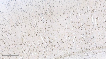 Aryl Hydrocarbon Receptor Antibody Rat Brain IHC. Immunohistochemical staining of FFPE rat brain tissue demonstrates AHR expression using an Aryl Hydrocarbon Receptor antibody. AHR, also known as an Environmental Sensor Protein, is a ligand activated transcription factor that integrates signals from endogenous metabolites, dietary compounds, and environmental toxicants to regulate gene expression and immune responses. Widespread nuclear staining is observed throughout neuronal populations and scattered glial cells, reflecting the role of AHR in maintaining neural homeostasis and modulating neuroinflammatory pathways. Heat induced epitope retrieval was performed by boiling tissue sections in pH 8 EDTA buffer for 20 minutes followed by cooling prior to staining. These results support the utility of AHR Antibody for studies of neurobiology, transcriptional regulation, and environmental sensing mechanisms.
