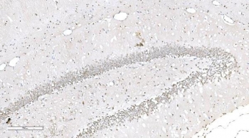 Aryl Hydrocarbon Receptor Antibody Hippocampus IHC. Immunohistochemical staining of FFPE rat brain tissue demonstrates AHR expression using an Aryl Hydrocarbon Receptor antibody. AHR, also known as an Environmental Sensor Protein, is a ligand activated transcription factor that regulates xenobiotic responses, immune signaling, and neuronal homeostasis. Prominent nuclear staining is observed within densely packed neuronal layers of the hippocampal formation, while scattered positive cells are present throughout the surrounding parenchyma. This distribution is consistent with emerging roles for AHR in neurodevelopment, synaptic plasticity, and responses to endogenous metabolic cues. Heat induced epitope retrieval was performed by boiling tissue sections in pH 8 EDTA buffer for 20 minutes followed by cooling prior to staining. These findings support the utility of AHR Antibody for studies of neurobiology, environmental sensing, and transcriptional regulation.