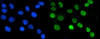 Aryl Hydrocarbon Receptor Antibody A431 Cells IF. Immunofluorescent staining of FFPE human A431 cells demonstrates AHR expression using an Aryl Hydrocarbon Receptor antibody (green). AHR, also known as an Environmental Sensor Protein, is a ligand activated transcription factor that translocates to the nucleus following activation by endogenous metabolites and xenobiotic ligands. Strong nuclear fluorescence is observed, consistent with the role of AHR in regulating transcriptional responses and cellular adaptation to environmental stimuli. DAPI nuclear stain identifies cell nuclei (blue). Heat induced epitope retrieval was performed by steaming sections in pH 6 citrate buffer for 20 minutes prior to staining. These results support the utility of AHR Antibody for studies of toxicology, signal transduction, and transcriptional regulation.