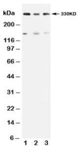 Western blot testing of ATM antibody and Lane 1:  rat testis;  2: U87;  3: MCF-7