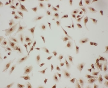 ICC testing of LASP1 antibody and A549 cells