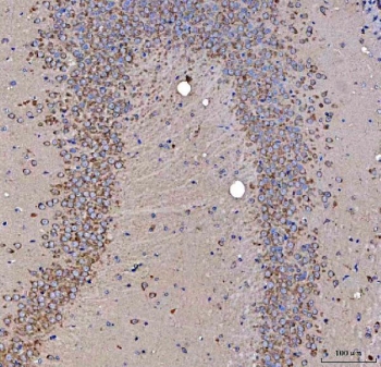 IHC staining of FFPE mouse hippocampus tissue with SSR3 antibody. HIER: boil tissue sections in pH8 EDTA for 20 min and allow to cool before testing.