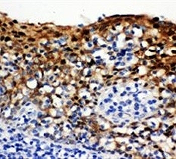 IHC-P: 14-3-3 sigma antibody testing of human tonsil tissue. HIER: boil tissue sections in pH6, 10mM citrate buffer, for 20 min and allow to cool before testing.
