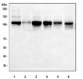 Western blot testing of 1) human HeLa, 2) human Ramos, 3) human MCF7, 4) human Jurkat, 5) rat testis and mouse testis tissue lysate with Daxx antibody. Predicted molecular weight ~81 kDa but routinely observed at ~120 kDa, the slow SDS-PAGE migration possibly due to the proteins high acidic residue content.