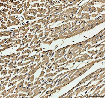 IHC staining of FFPE rat heart tissue with Myoglobin antibody. HIER: boil tissue sections in pH8 EDTA for 20 min and allow to cool before testing.