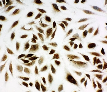 ICC testing of NM23 antibody and HeLa cells.