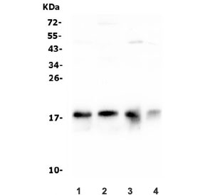 Western blot testing of 1) rat heart, 2) rat brain, 3) mouse heart and 4) mouse brain lysate with NME2 antibody. Predicted molecular weight: ~17 kDa.