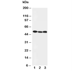 Western blot testing of Beclin 1 antibody and Lane 1:  HeLa;  2: SW620;  3: PANC cell lysate.  Predicted and Observed size: 49KD