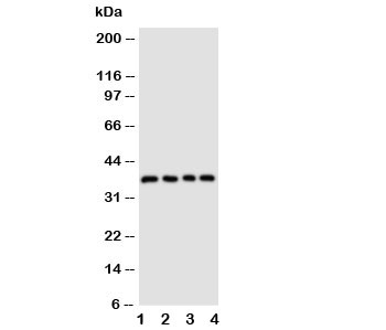 CD1D Antibody for WB western blot analysis of CD1d antigen in human cell lysates. Lane 1: COLO320 cell lysate, Lane 2: HeLa cell lysate, Lane 3: HT1080 cell lysate, Lane 4: Jurkat cell lysate. A band is detected at approximately 33-36 kDa, consistent with the predicted molecular weight of CD1d / CD1D. CD1d is a non-classical MHC class I-like glycoprotein that associates with beta-2-microglobulin and presents lipid antigens to natural killer T cells, and glycosylation of the extracellular domain can contribute to the slightly higher apparent molecular weight commonly observed on SDS-PAGE.