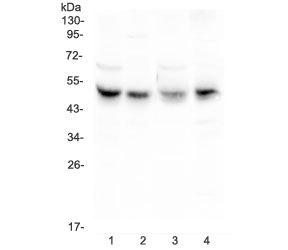 Western blot testing of 1) rat liver, 2) rat heart, 3) mouse liver and 4) mouse HEPA1-6 lysate with CAR antibody at 0.5ug/ml. Expected molecular weight: 40-50 kDa.