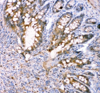 FABP5 Antibody Rat Intestine IHC. Immunohistochemistry staining of FFPE rat intestine tissue with FABP5 antibody. HIER: boil tissue sections in pH8 EDTA for 20 min and allow to cool before testing.