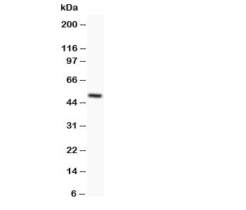 Western blot testing of Orai1 antibody and SKOV lysate;  Predicted molecular weight ~ 33 kDa;  Observed size 45~50 kDa due to glycosylation