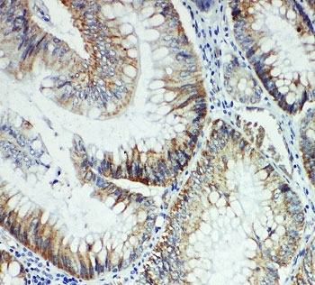 IHC-P: FER antibody testing of rat intestine tissue. HIER: steamed with pH6 citrate buffer.