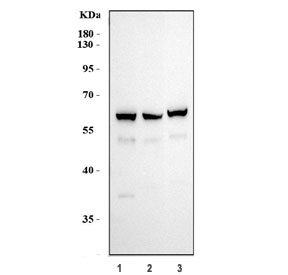Western blot testing of human 1) HeLa, 2) MCF7 and 3) MDA-MB-453 cell lysate with Smad2 antibody. Predicted molecular weight: 52~60 kDa.
