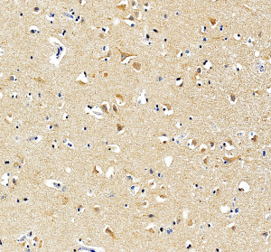CSF1R Antibody IHC in Human Brain. Immunohistochemistry of FFPE human brain tissue was performed with CSF1R Antibody at 2 ug/ml following heat-induced epitope retrieval in pH 8 EDTA buffer. Brown staining is present in a population of scattered cells within the brain tissue, with predominantly cytoplasmic and membranous labeling. The staining supports tissue detection using an M-CSF Receptor Antibody.