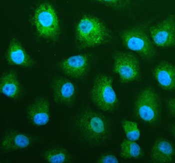 Immunofluorescent staining of FFPE human A549 cells with MALT1 antibody (green) and DAPI nuclear stain (blue). HIER: steam section in pH6 citrate buffer for 20 min.