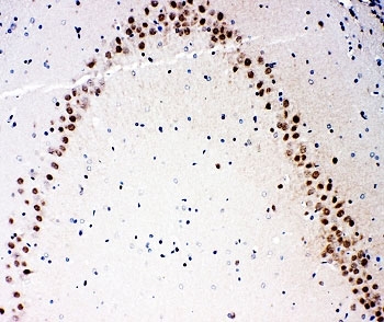 IHC-P: MEKK3 antibody testing of rat brain tissue