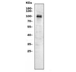 Western blot testing of human Raji cell lysate with MYBL2 antibody. Predicted molecular weight: ~79 kDa, may also be observed at 100~110 kDa.