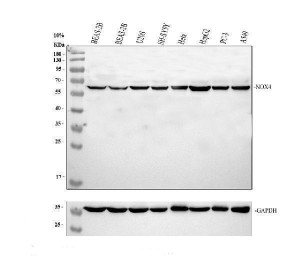 NOX4 Antibody Human Cell Line WB. Western blot analysis was performed using NOX4 Antibody. Lane 1: human BEAS-2B whole cell lysate; lane 2: human BEAS-2B whole cell lysate; lane 3: human U2OS whole cell lysate; lane 4: human SH-SY5Y whole cell lysate; lane 5: human HeLa whole cell lysate; lane 6: human HepG2 whole cell lysate; lane 7: human PC-3 whole cell lysate; lane 8: human A549 whole cell lysate. Proteins were separated on a 10% SDS-PAGE gel, transferred to a nitrocellulose membrane, and incubated with the primary antibody at 0.5 ug/ml overnight at 4Â°C. A specific immunoreactive band is detected at approximately 67 kDa in all tested cell lines, consistent with the expected molecular weight of NOX4. These results demonstrate that this Reactive Oxygen Species Enzyme Antibody is suitable for Western blot detection of NOX4 across multiple human cell lines.