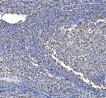 IHC staining of FFPE human tonsil tissue with Nucleophosmin antibody. HIER: boil tissue sections in pH8 EDTA for 20 min and allow to cool before testing.