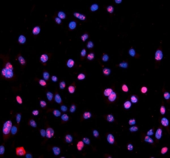 Immunofluorescent staining of FFPE human Caco-2 cells with Nucleophosmin antibody (red) and DAPI nuclear stain (blue). HIER: steam section in pH6 citrate buffer for 20 min.