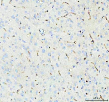 IHC staining of FFPE rat brain tissue with Aquaporin 4 antibody. HIER: boil tissue sections in pH8 EDTA for 20 min and allow to cool before testing.