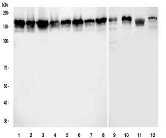 Western blot testing of 1) human RT4, 2) human A431, 3) human HepG2, 4) human HaCaT, 5) human MCF7, 6) human U-2 OS, 7) human HeLa, 8) human PC-3, 9) rat liver, 10) rat RH35, 11) mouse liver and 12) mouse HEPA1-6 cell lysate with ZO-2 antibody.  Expected molecular weight: 131-160 kDa.