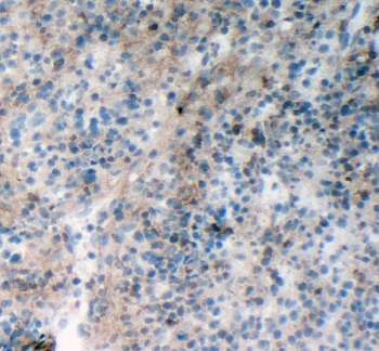 IHC-F: RIAM antibody testing of rat spleen tissue