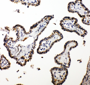 IHC-P: CUEDC2 antibody testing of human thyroid cancer tissue