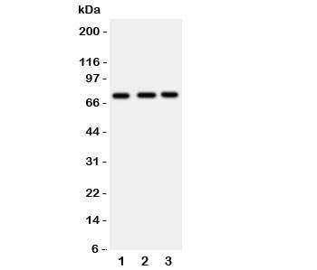 Western blot testing of VASA antibody and Lane 1:  rat testis;  2: mouse testis;  3: (m) ovary tissue lysate