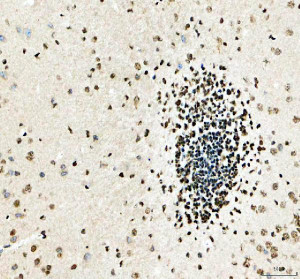 DNA-PKcs Antibody Mouse Brain IHC. Immunohistochemical staining of FFPE mouse brain tissue using DNA-PKcs antibody. Heat-induced epitope retrieval was performed in pH 8.0 EDTA buffer before incubation with DNA-PKcs antibody at 2 ug/ml. An HRP-conjugated secondary antibody with DAB chromogen was used for visualization. Widespread nuclear staining is observed throughout the brain, with particularly strong immunoreactivity in densely populated neuronal cell layers, consistent with the nuclear localization of DNA-PKcs. This DNA-PKcs Antibody, also called PRKDC Antibody, is suitable for studies of DNA damage repair, non-homologous end joining, genome stability, and DNA repair signaling.