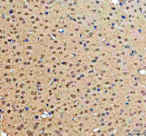 DNA-PKcs Antibody Rat Brain IHC. Immunohistochemical staining of FFPE rat brain tissue using DNA-PKcs antibody. Heat-induced epitope retrieval was performed in pH 8.0 EDTA buffer before incubation with DNA-PKcs antibody at 2 ug/ml. An HRP-conjugated secondary antibody with DAB chromogen was used for visualization. Diffuse nuclear staining is observed throughout the brain parenchyma, consistent with the widespread expression and nuclear localization of DNA-PKcs in neural tissue. This DNA-PKcs Antibody, also called PRKDC Antibody, is suitable for studies of DNA damage repair, non-homologous end joining, genome stability, and DNA repair signaling.
